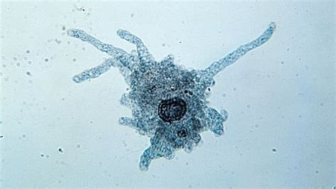  Kentrogon! A Single-Celled Amoeba That Thrives on Decay